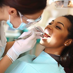 Teeth Whitening SmileXpert